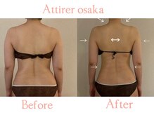 アティレ オオサカ(Attirer Osaka)/痩身/姿勢矯正/温活/ブライダル