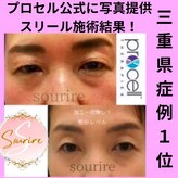 スリール(sourire)
