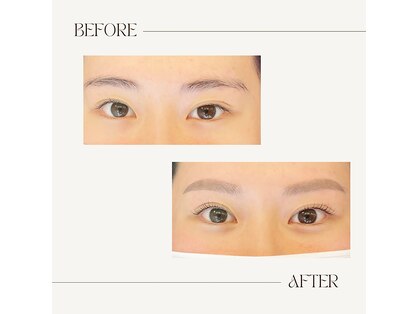 キチ(Kichi)の写真