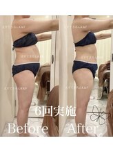 えすてさろん ケイアンドエフ(k&f)/実感できる。選ばれる痩身ケア