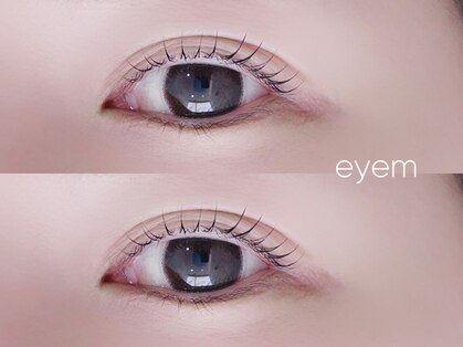 アイム(eyem)の写真