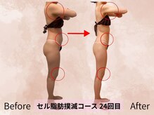 ハナ チュチュ(Hana chuchu)/セル脂肪撲滅コース　24回目