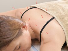 あすか鍼灸整骨院 アスカボディファクトリー(ASUKABodyFactory)/深部から肩こりケア