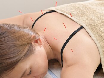 あすか鍼灸整骨院 アスカボディファクトリー(ASUKABodyFactory)/深部から肩こりケア