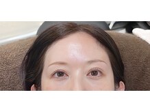 レコルトアイラッシュ(RECOLTE EYELASH)/上まつ毛パーマ