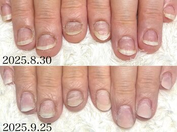 グレースレディ 大阪店/(深爪/長さだし/フィルイン)