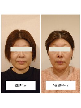 晴れ晴れ整体院/整顔効果が続く！小顔矯正