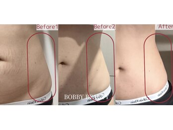 セルフィッシュ ボディ(Selfish body)/気になる箇所に