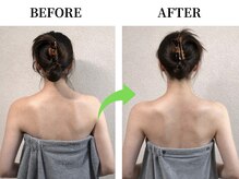イロハ 鳥取米子店(IROHA)/【美容整体のビフォーアフター】
