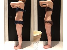 リボディ 表参道(An re Body)/before→after