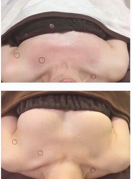 ディタ アンド ボーン(DITA&BORN)/デコルテ削げ解消