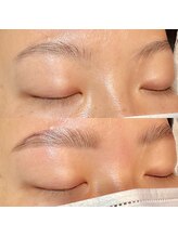 メル(me'r.)/ハリウッドブロウリフト