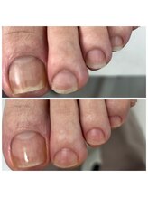 ドクターネイル爪革命 十条店/爪ケア