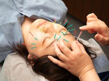 薮下整骨院 本厚木院の雰囲気（美容鍼で顔も体も整えむくみや小顔効果も◎#美容鍼#むくみ#小顔）