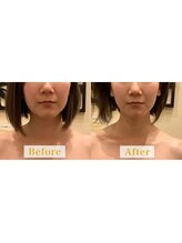 アジール 長岡リバーサイド千秋店(agir)/Before/After画像