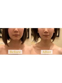 アジール 長岡リバーサイド千秋店(agir)/Before/After画像