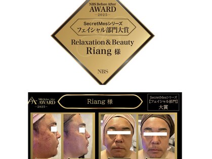 リアン(Riang)の写真