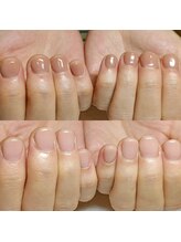 マニエネイル(mani e nail)/深爪矯正/3週間後のお爪の成長