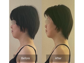 ハートランド(HEARTLAND)/仙台バストサロン 仙台姿勢矯正