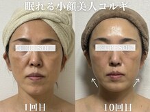 セレソル(CERESOL)の雰囲気（継続は力なり◎お得な継続割あります♪）