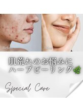 アンベリール(embellir)/ハーブピーリングコース