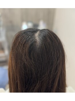 マイントゥー(mine too)/パックリパタンと割れてしまう髪