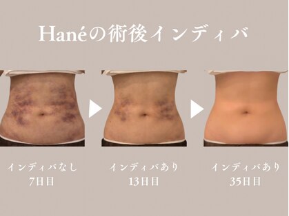 ハネ 自由が丘(Hane)の写真