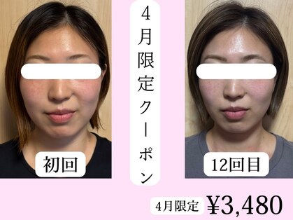 asmot鍼灸 整体院 代々木上原(asmot鍼灸 整体院)の写真