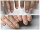 ブルームーンネイルズ(BLOOMOON.nails)の写真/【人に見せるのが嫌だった指先が120分で“隠さない手元”へ☆長年の爪コンプレックスを自然で美しく！】