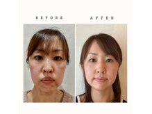 ディオ(Dio)の雰囲気(元肌迷子スタッフが対応。気持ちが痛いほどわかるから全力です!)