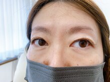 ルピナス 武蔵小金井店(Lupinus)/フラットラッシュ140本