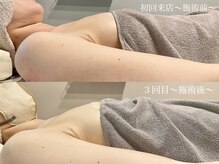 ティアモ(Ti Amo)/Before/After