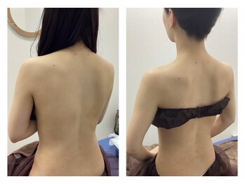 イコット(icotto)/icottoブライダルコース