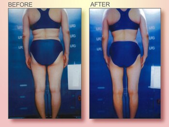 ジュリア オージェ 京橋店/ビフォーアフター(脂肪燃焼)