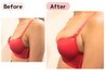 【デコルテの隙間・下垂・産後授乳後のお悩み改善】まんまるふっくらバストに