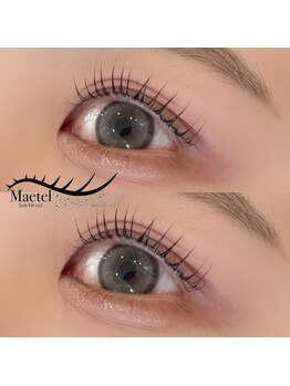 ゼン(Zen)/メーテルラッシュリフト