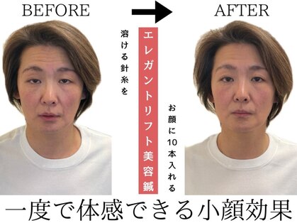 友愛はりきゅう美容整体院の写真