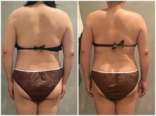 ツーアップ(2up)/背中お尻むくみ,肩こり