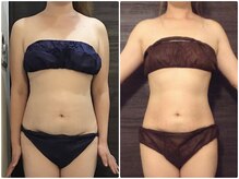 美容整体 ウェリナ 蟹江院/小顔矯正/骨盤矯正/美脚サロン 