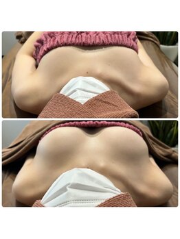 ロココ 豊田店(Rococo)/ビフォーアフター