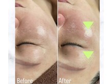 グロウ(GLOW)/次世代ラミネーションピール