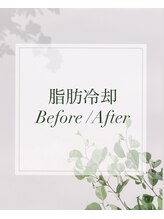 ヴィーナス 三ツ境店(VENUS)/【最新】3Dサラウンドクライオ