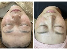 ミニマル(minimal)の雰囲気(大好評★シミケア!!White Lab導入★ビフォアフ必見!!)