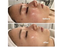 アースネイル 大曽根店(EARTH Nail)の雰囲気（お客様のお肌状態に合わせて丁寧に施術いたします。）