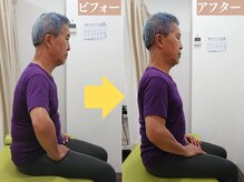 修学院整骨施術院の雰囲気（施術のビフォーアフター【腰痛/肩こり/整体/骨盤矯正/姿勢矯正】）