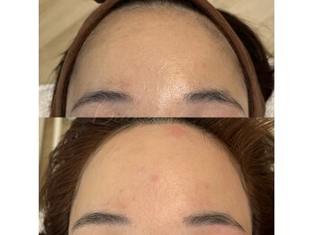 ベルアイラッシュ(Belleyelash)/【フェイシャルワックス】