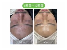 ケーナインエッセ(K9 esse)/ハーブピーリングBefore→After