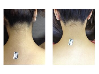 シンプル 中野(Simple)/継続が大切です！