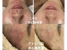 ジェニー(JENNI)の雰囲気（お肌ケアはお任せください！LDM/トロイアルケ/ララピール/ハーブ）