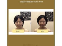 アジール 長岡リバーサイド千秋店(agir)/Before/After画像